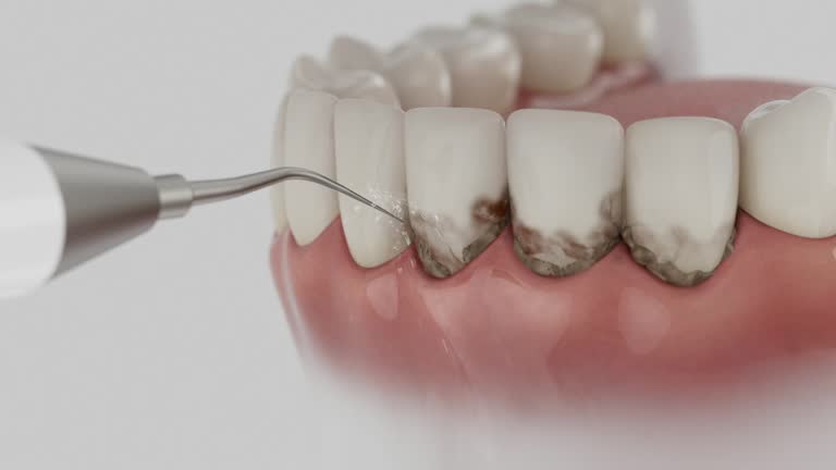 Trusted Teeth Cleaning And Checkup service in Denison, TX - Dentist Open Now